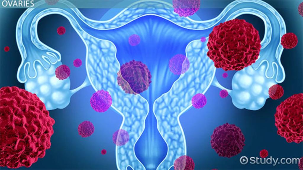 - Addressing Female Reproductive Disorders: ‍Symptoms, Treatments, and Lifestyle Tips